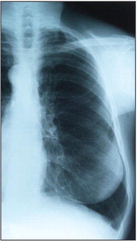 Common respiratory ailments Common respiratory ailments